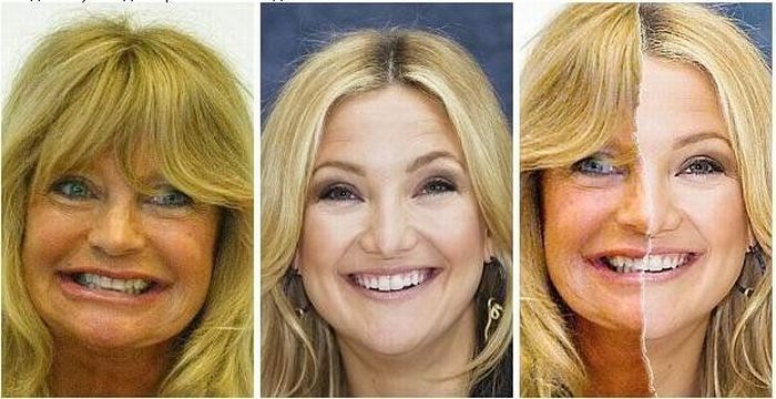 Goldie Hawn ir jos dukra Kate Hudson